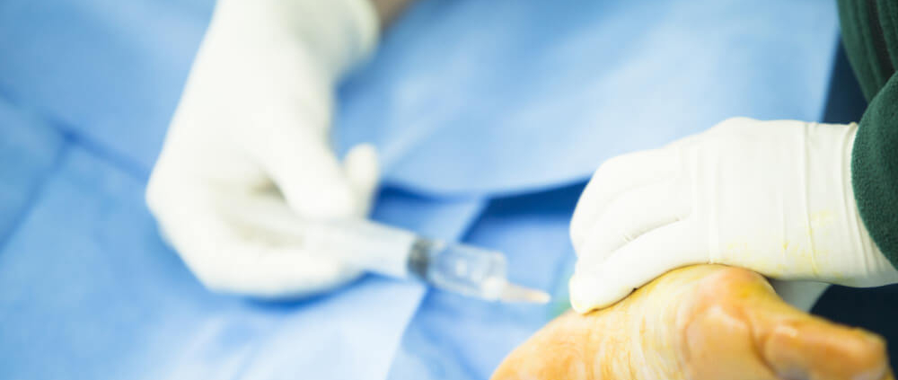 cirugía podológica