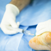 cirugía podológica