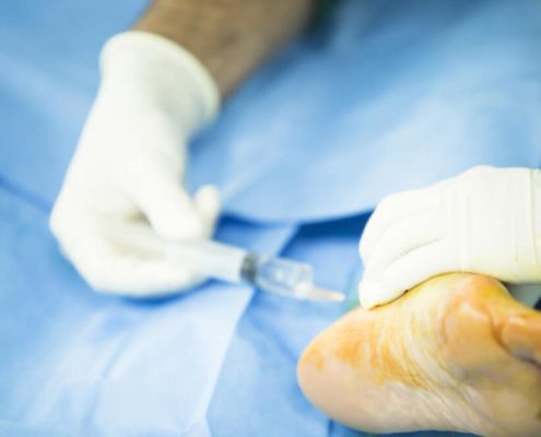 cirugía podológica