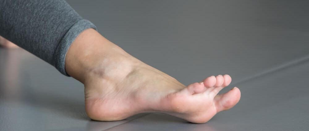 pie plano y el pie cavo