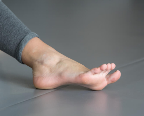 pie plano y el pie cavo